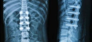 x-ray von der Rückseite